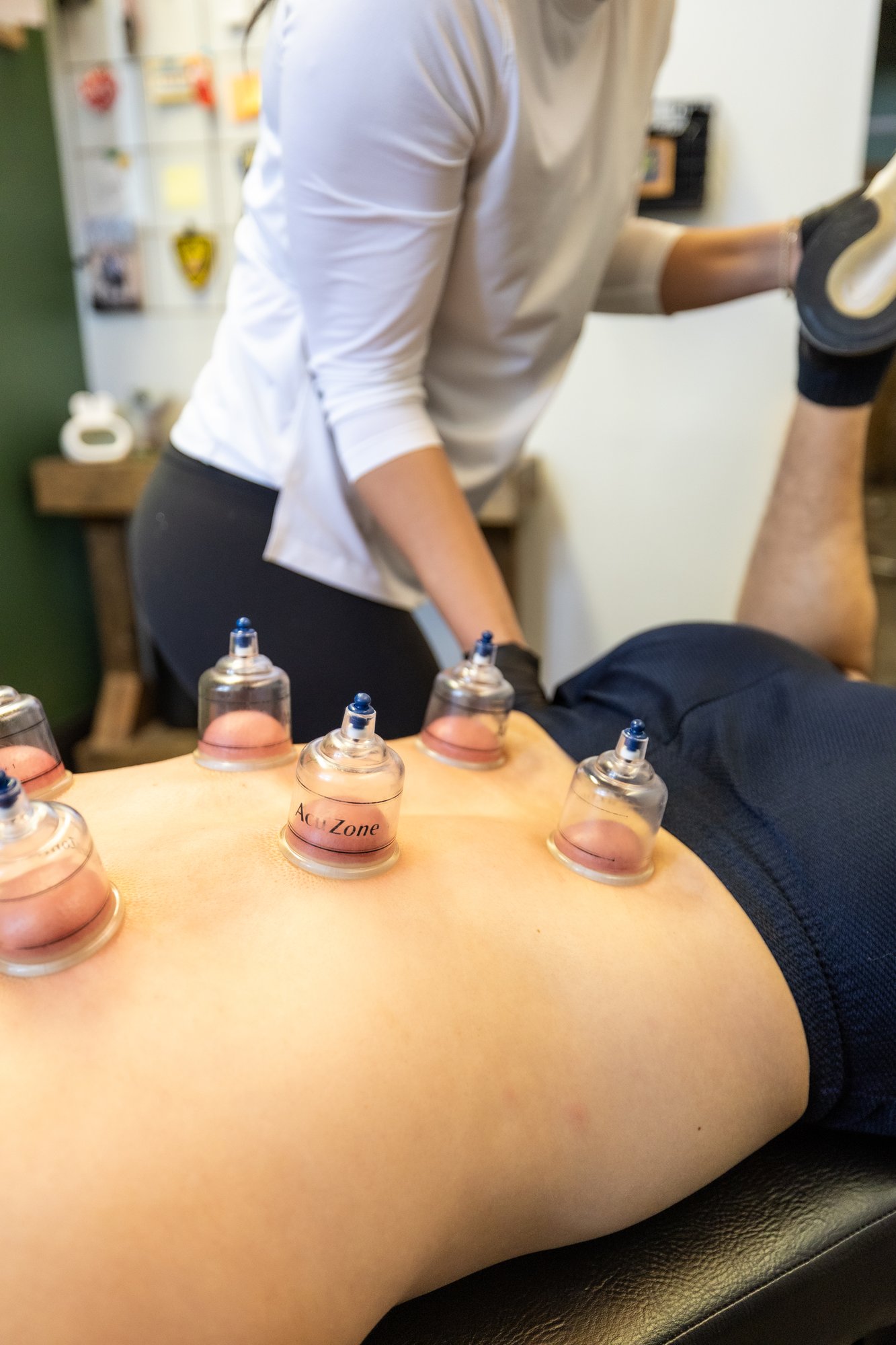dry-needling-naperville